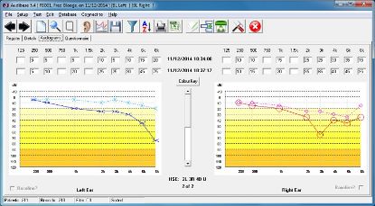 Audiometer Audiometric Audibase Pc Database