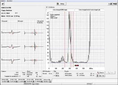 [MPS70.610100] Sema Light Data Management Software (Schiller)