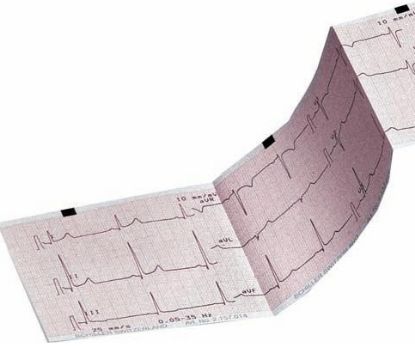 [MPS72.157046] Ecg Paper Z-Fold Schiller M5-2010 Thermosensitive