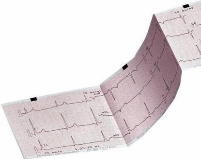 [MPS2CT480ZPi] ECG PAPER Z-FOLD A4 (CT8000P) 9690029200
