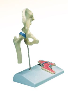 [MPAW4523] Model Hip Joint Miniature On Stand